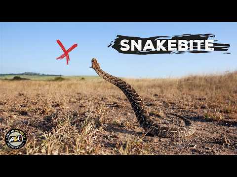 First Aid for Snakebite in Africa