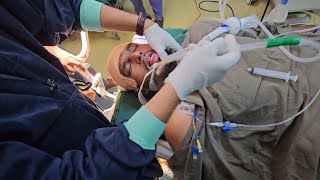 Craniotomy #removalofbraintumour#anesthesia #anesthesia #neurosurgery#craniotomy