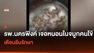 รพ.นครพิงค์ เจอหนอนในจมูกคนไข้ 100 ตัว เตือนรีบรักษา I Thai PBS news