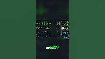 Decoding QRS Complex: Wide vs. Narrow Explained Simply