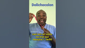 C'est quoi un dolichocôlon ?