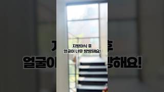 지방이식 후 얼굴이 너무 빵빵한데 괜찮나요?