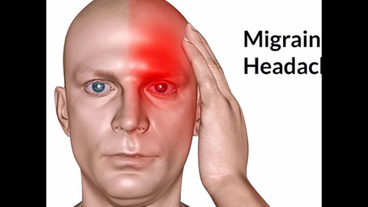 Болит правая сторона головы. Боли в лице левого глаза. Боли в лице левого глаза. Человек трет глаза. Воспаление троичного нерва.