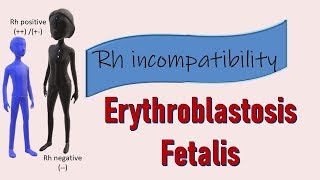 Rh incompatibility II Erythroblastosis fetalis II Prevention with Rhogam