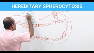 Hereditary Spherocytosis | Diagnosis & Treatment | Genetics‍⚕