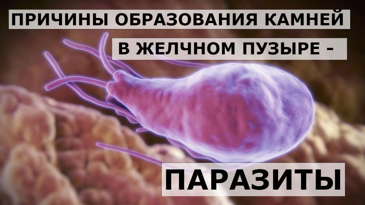 паразиты желчном пузыре человека симптомы паразиты желчном пузыре человека симптомы