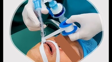 (HD NHANH)KỸ THUẬT ĐẶT ỐNG NKQ TRÊN NGƯỜI TRƯỞNG THÀNH CHO NGƯỜI MỚI TẠI PHÒNG MỔ. (STEP BY STEP).