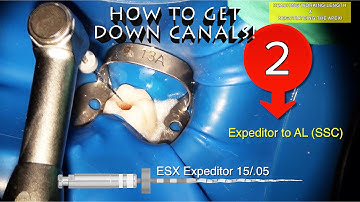 How to get down tough canals