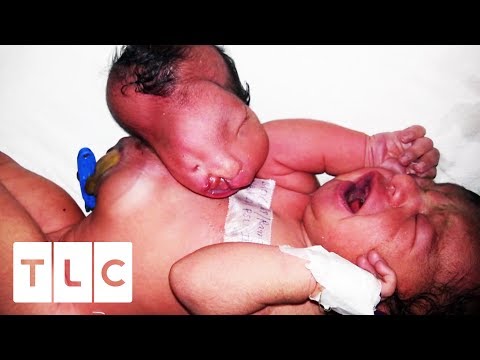 Video: American Surgeons Removed The Baby's Foot In The Head (3 Photos)