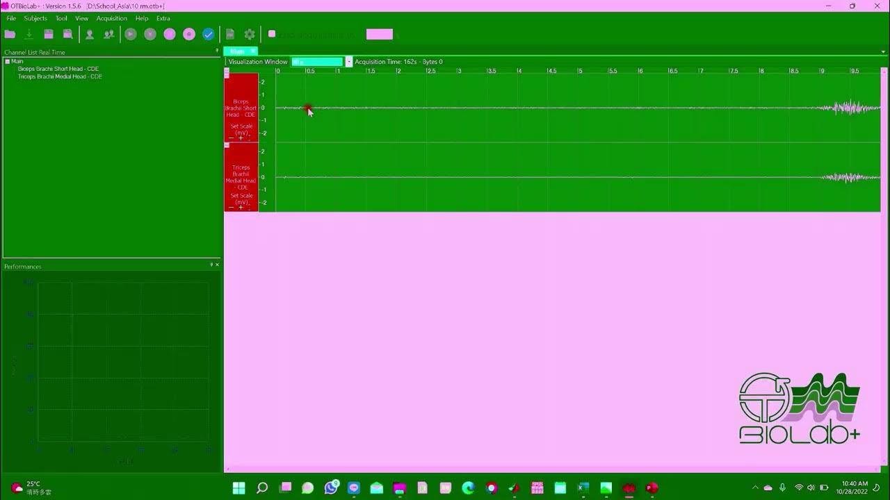 How To Retrieve EMG Data YouTube how-to-retrieve-emg-data-youtube