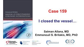 Case 159: Manual of PCI - I closed the vessel