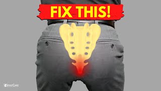 How to Fix Tailbone Pain for Good