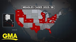 CDC warns health providers about the rise of measles cases