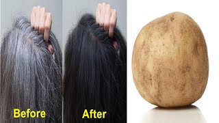 Grey hair to black hair treatment with Potato  white hair solution​ at home