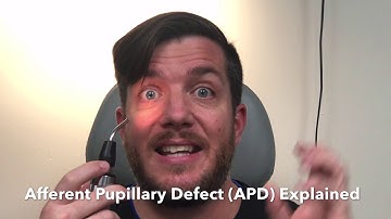 Afferent Pupillary Defect - APD Explained