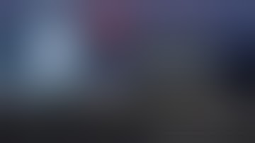 Reduced-port Robotic Distal Gastrectomy D2 dissection,  Billroth I anastomosis, and cholecystectomy