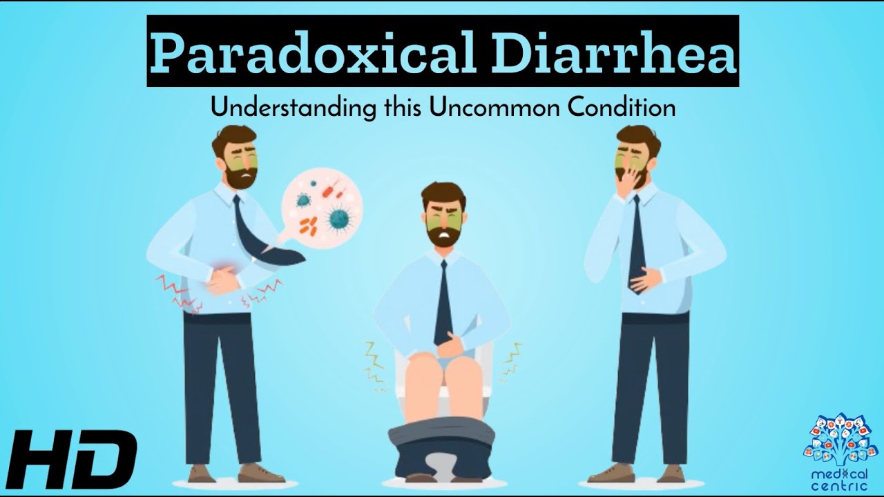 The Oddity of Paradoxical Diarrhea A Deep Dive into the YouTube