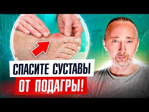 Средство от Подагры №1: Как вывести мочевую кислоту из организма?