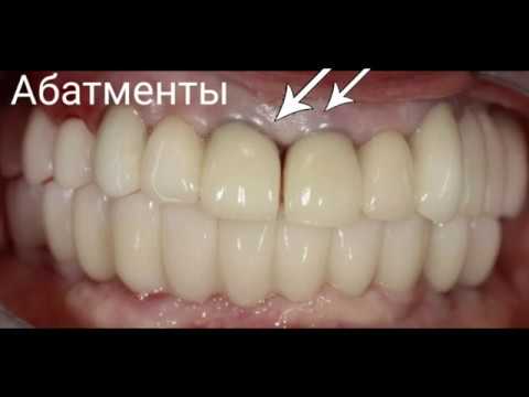 Почему десна синеет? Разбираем все случаи изменения цвета десен!