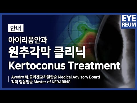 [아이리움안과] 원추각막 클리닉 (Keratoconus Treatment)