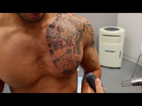 THE TATTOO REMOVAL PROCESS - YouTube