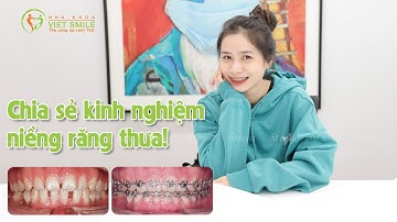 Chia sẻ kinh nghiệm sau 1 năm niềng răng thưa - KH Nguyễn Thị Ngọc Hân S1015
