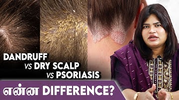 Dandruff இருந்தா Oil Apply பண்ணாதீங்க! - Dr Radha Subramaniyan | Dandruff Do