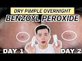 OVERNIGHT SOLUTION FOR ACNE (MURA AT EFFECTIVE)