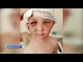 Следком России взял на контроль инцидент с ребенком в Башкирии, у которого в крови обнаружили спирт