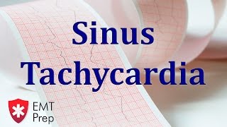 Sinus Tachycardia ECG - EMTprep.com