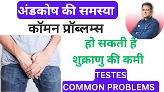 अंडकोष की कॉमन प्रॉब्लम्स । Testes common problems ।