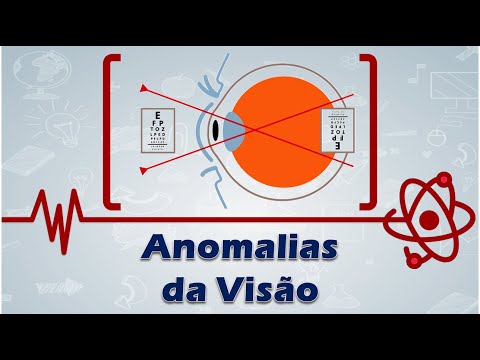 Vídeo: Fenômenos Anormais Em Babushkinskaya - Visão Alternativa