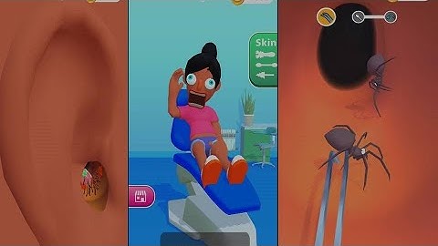 Earwax Clinic New All Levels Game Mobile iOS,Android  Walkthrough Gameplay EWCGP03