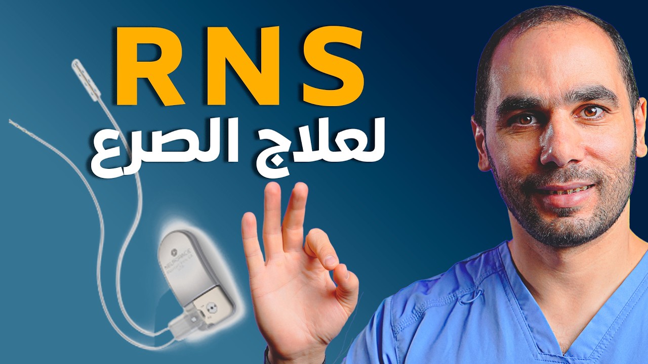شرح جهاز RNS: حل حديث لمشكلة الصرع المستعصي