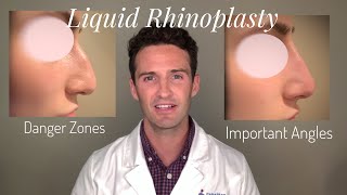 Liquid Rhinoplasty: Everything you need to know!