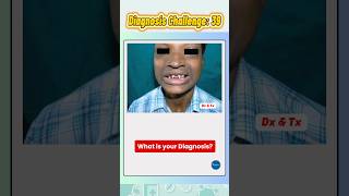 🧠 Endodermal Dysplasia – Can You Diagnose This Case? | Clinical MCQ Challenge