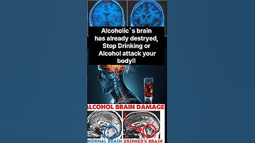 Alcoholics have already destroy your brain. Stop drinking a little by a little.