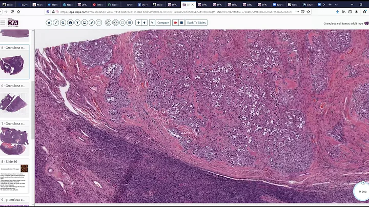 Digital Pathology Sign out 25