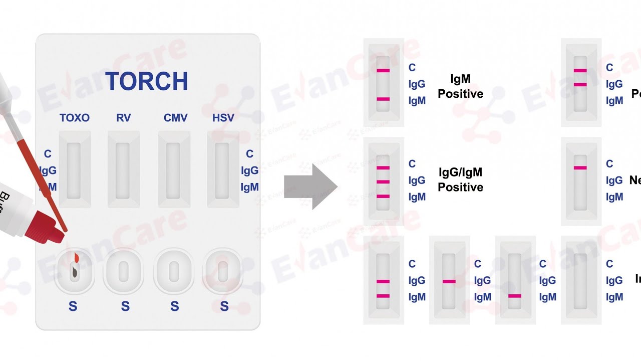 TORCH test.How many tests included in TORCH test.Importance & all ...