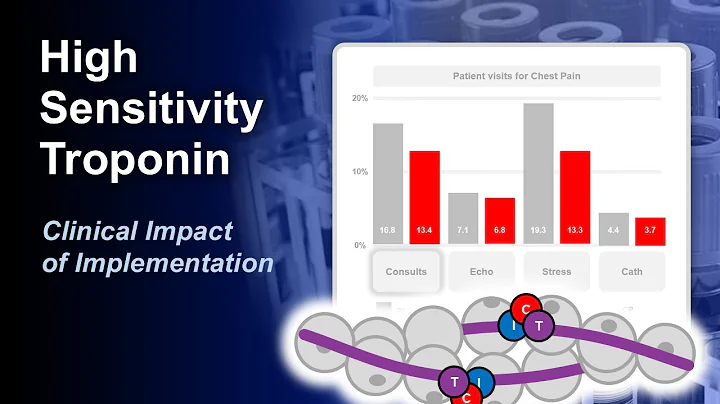 High Sensitivity Troponin - Clinical Impact of Implementation