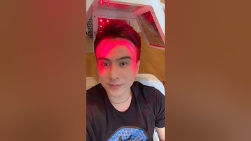 [ Vlog #15 ] Hành trình cấy tóc tự thân: Đây là phương pháp quá tốt nên mình chia sẻ tới mọi người