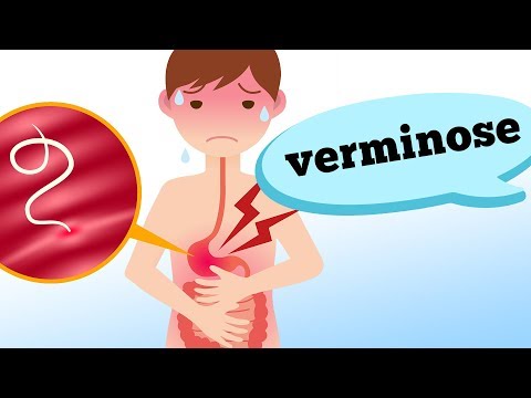 Vídeo: Os vermes lentos podem morder?