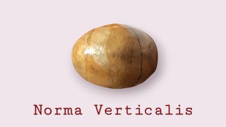 Superior view of skull | Norma verticalis