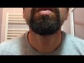 Beard Trimming- a 15 month beard - goatee beard - Braun MGK 3080 All in One
