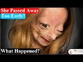 15-Years-Old Youtube Star Adalia Rose Left us Forever ~ Her Last Videos ~ Body Bizarre!