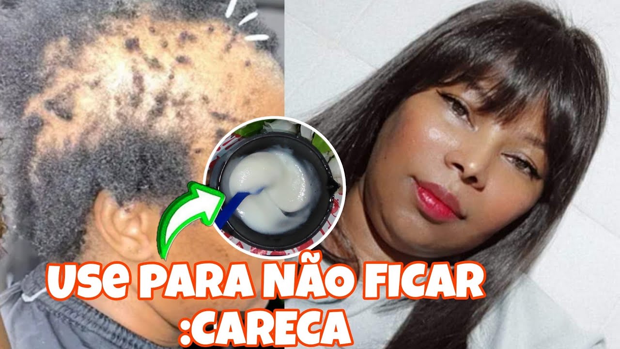 VOCÊ PRECISA USAR, é Inacreditável a TRANSFORMAÇÃO que Ele Faz!