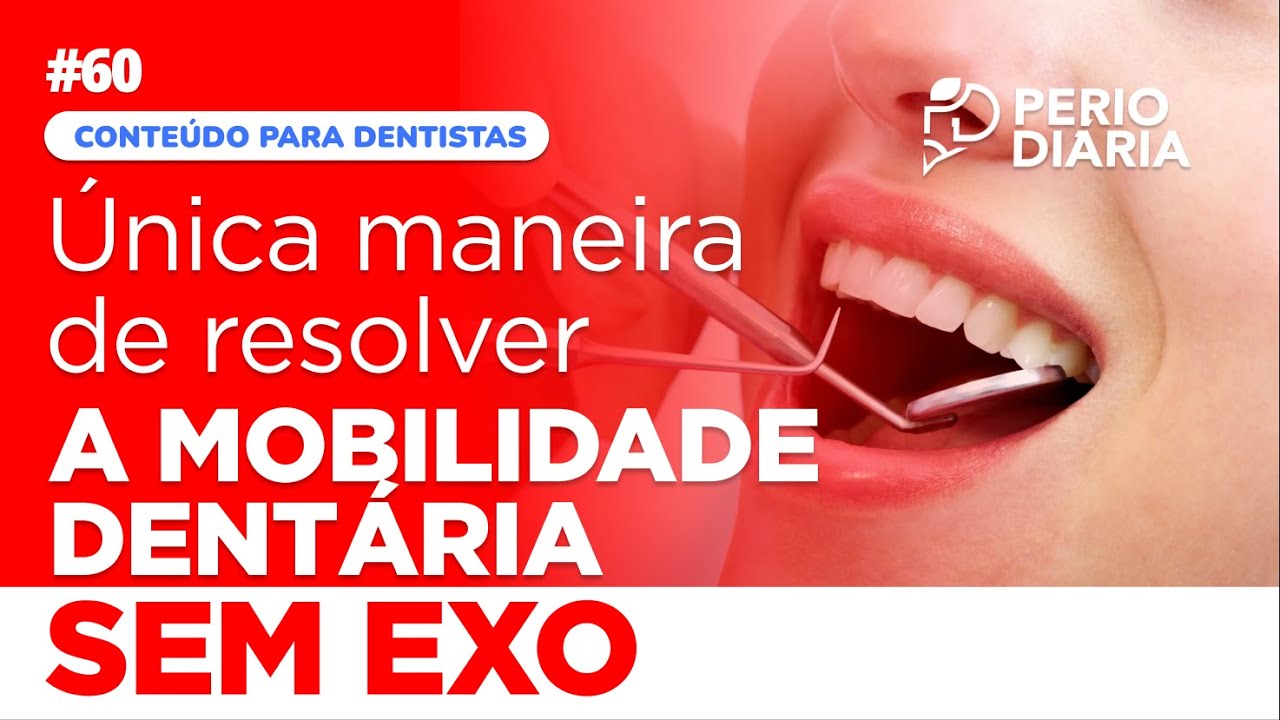 #60 - Única maneira de resolver a MOBILIDADE dentária sem EXO