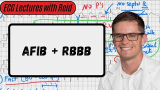 Atrial Fibrillation w/ Right Bundle Branch Block | Day 15 ECG Challenge