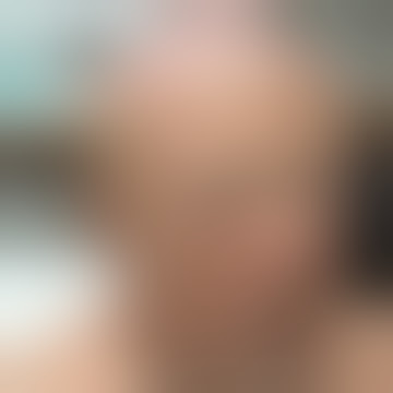 Ngeri!!!kepala di belah hingga otak nya terlihat