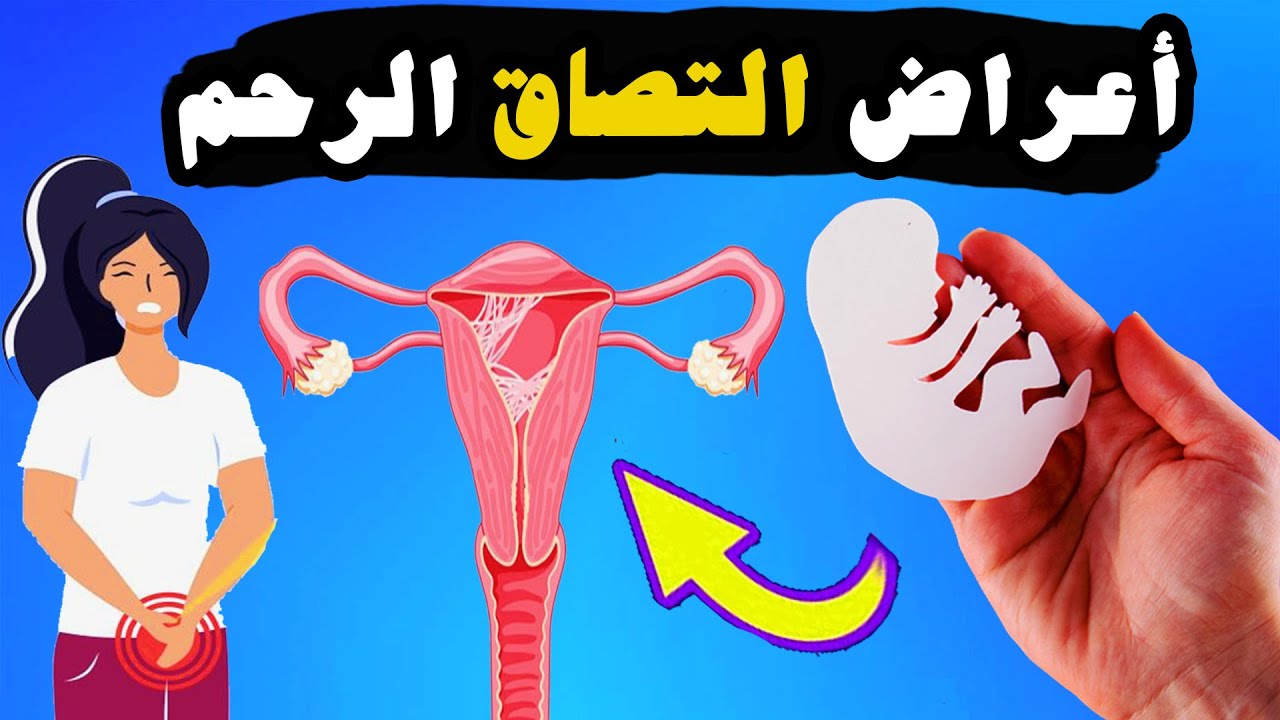 أعراض التصاق الرحم